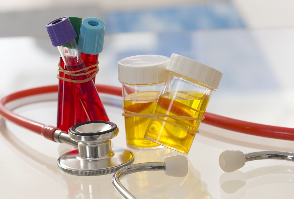 Synthetic Urine News Nicks Place Vancouver WA